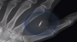 Photo-Implant-Party-France-implantation-puce-main-Bionyfiken_1434484130_300x